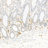 Anti -14-3-3 alpha + beta Mouse mAb