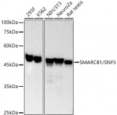 [KO Validated] SMARCB1/SNF5 Rabbit mAb (A3247)