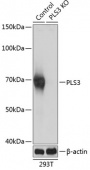 [KO Validated] PLS3 Rabbit pAb (A19956)