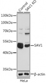 [KO Validated] SAV1 Rabbit pAb (A18667)