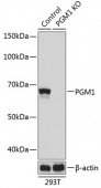 [KO Validated] PGM1 Rabbit pAb (A19905)