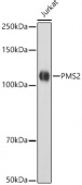 [KO Validated] PMS2 Rabbit mAb (A22350)