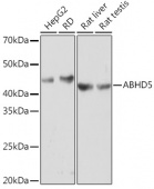 ABHD5 Rabbit mAb (A8673)