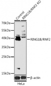 [KO Validated] RING1B/RNF2 Rabbit pAb (A18076)