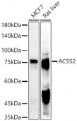 ACSS2 Rabbit pAb (A13596)