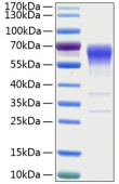 Active Recombinant Human Activin RIIB/ACVR2B Protein (RP00153)