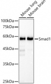 [KO Validated] Smad1 Rabbit mAb (A22326)