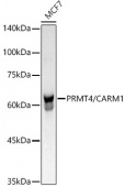 [KO Validated] PRMT4/CARM1 Rabbit mAb (A21106)